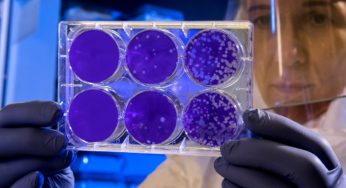 Could cannabis-based drugs against COPD also treat COVID-19 symptoms?