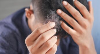Cannabis May Be Effective in Preventing Hair Loss, Study Shows